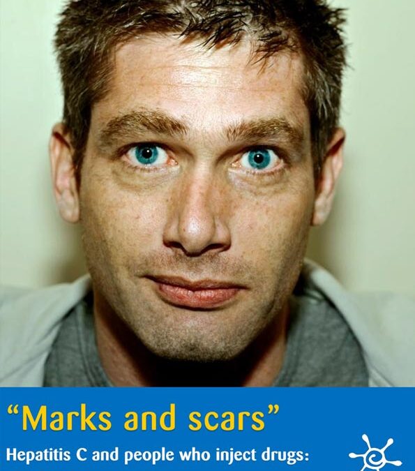 “Marks and Scars” HepatitisC and people who inject drugs